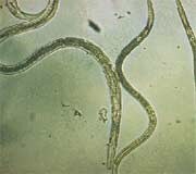 Eelworms